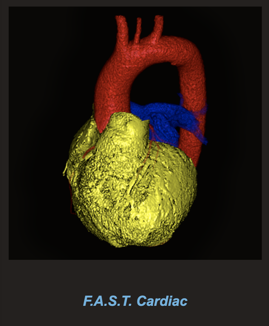 F.A.S.T. Cardiac