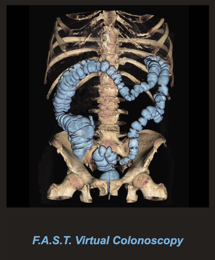 F.A.S.T. Virtual Colonoscopy