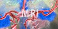 MRI
