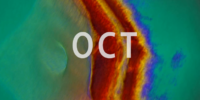 OCT