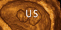 US
