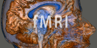 fMRI